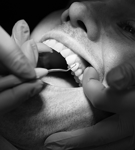 Parodontologi kursus